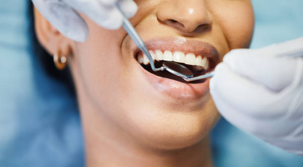 Best Emergency Wisdom Teeth Removal in Pawhuska, OK